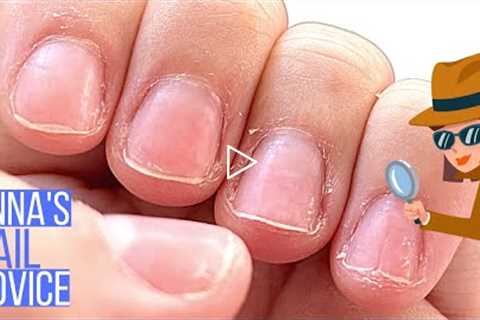 Why Are These Nails Weak? Find Out. [Anna's Nail Advice]