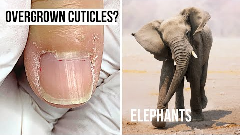 What Do Elephants & 'Overgrown Cuticles' Have In Common?