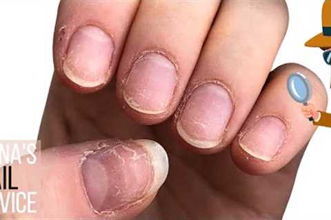 Nail damage, HEMA fears, allergic reactions & what nail tech doesn't tell you. [Anna's Nail..